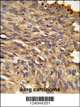 HDLBP Antibody (Center)
