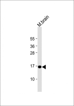 CPLX1 Antibody (Center)