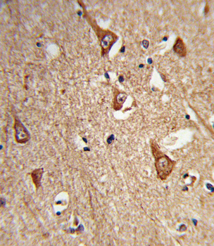 CPLX1 Antibody (Center)
