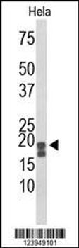 ACP1 Antibody (N-term)