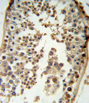 p19 Antibody (N-term)