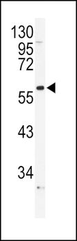ADRA1B Antibody (Center)