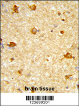 DIRAS1 Antibody (Center)