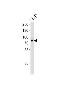 EXT2 Antibody (Center)