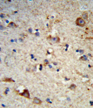 EXT2 Antibody (Center)