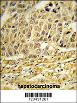 CCNB1IP1 Antibody (C-term)