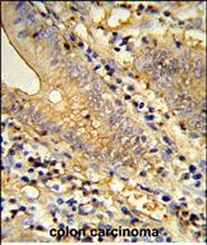 TSPAN33 Antibody (C-term)