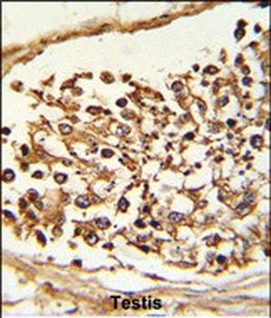 JMJD2B Antibody (N-term)