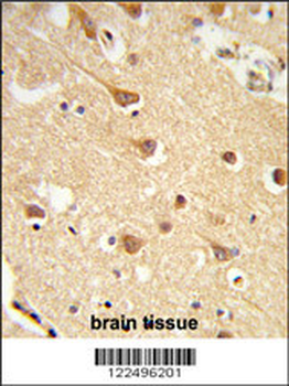 ND2 Antibody (N-term)