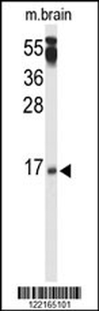 PPP3R2 Antibody (N-term)