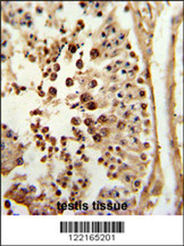 PPP3R2 Antibody (N-term)