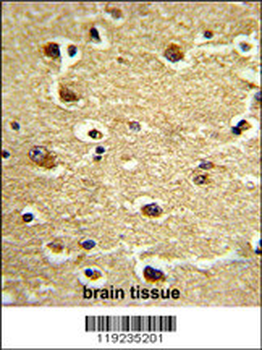 CROT Antibody (N-term)