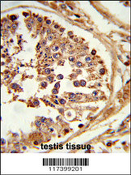 LIPE Antibody (C-term)