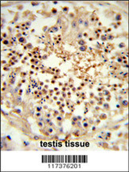 UNC119 Antibody (Center)