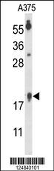 FA96B Antibody (N-term)