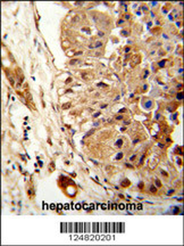 ATLA2 Antibody (Center)