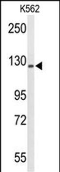TREF1 Antibody (C-term)