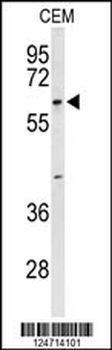 TCHP Antibody (Center)