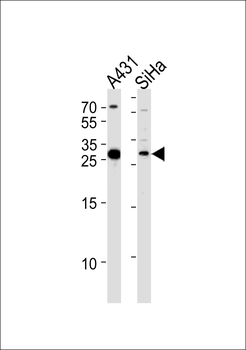 HSD17B12 Antibody (Center)