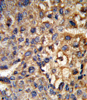 HSD17B12 Antibody (Center)