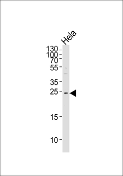 HCCA2 Antibody (N-term)