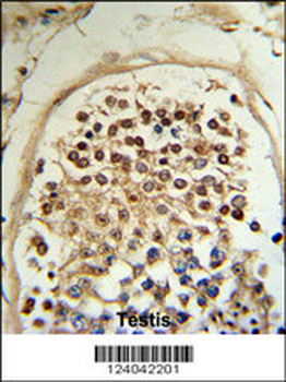 HCCA2 Antibody (N-term)