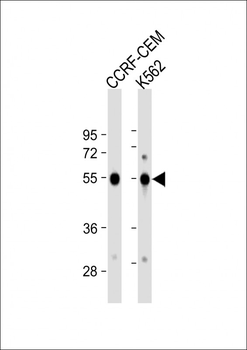 GALR1 Antibody (Center)