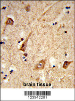 GALNT2 Antibody (N-term)