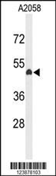 EYA4 Antibody (C-term)