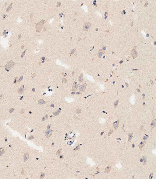 DLL3 Antibody (C-term)