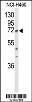 DDX17 Antibody (N-term)