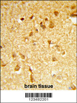 DDX17 Antibody (N-term)