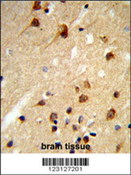 CENPK Antibody (C-term)