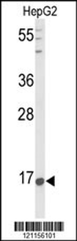 PNOC Antibody (Center)