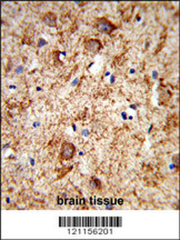 PNOC Antibody (Center)