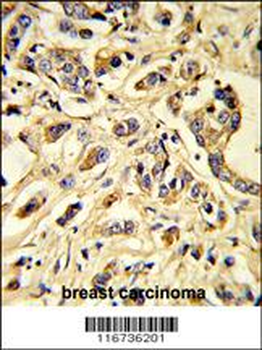 VGFR1 Antibody