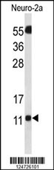 SH3BGRL3 Antibody (Center)