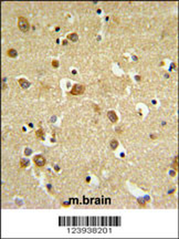 GABRD Antibody (Center)