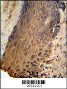 GFPT2 Antibody (Center)