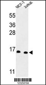 SNRPD3 Antibody (C-term)