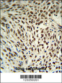 SNRPD3 Antibody (C-term)