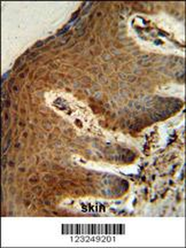 PTMS Antibody (C-term)