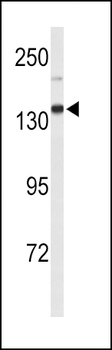 XDH Antibody (N-term)