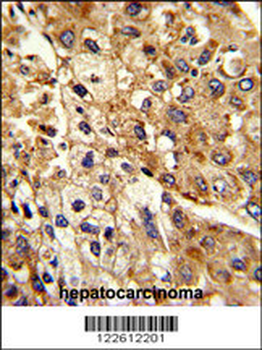 ATP1B2 Antibody (Center)
