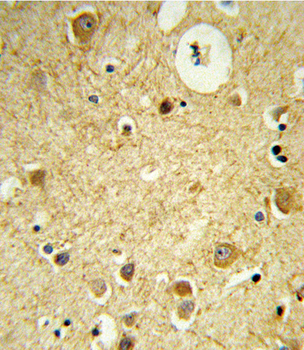 RECK Antibody (Center)