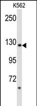 PLCB2 Antibody (N-term)