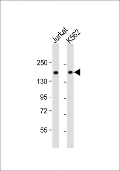 TOP2A Antibody (C-term)