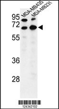 BEST2 Antibody (C-term)