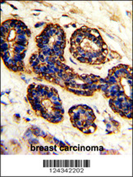 BEST2 Antibody (C-term)