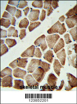 ATP5C1 Antibody (N-term)